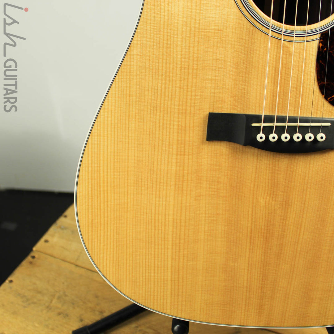 2015 Martin DCPA4 Rosewood