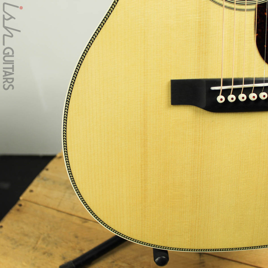 Martin Custom Shop 000-28 Wild Grain Rosewood Adirondack Spruce HD